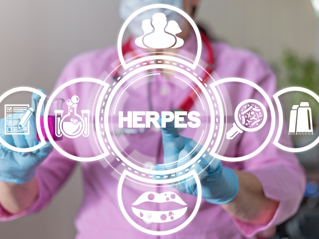 herpes, dobré zdravie,