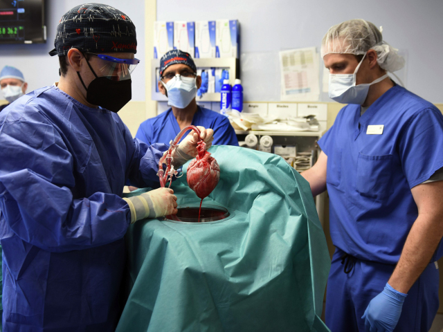 transplantácia, srdce, prasa