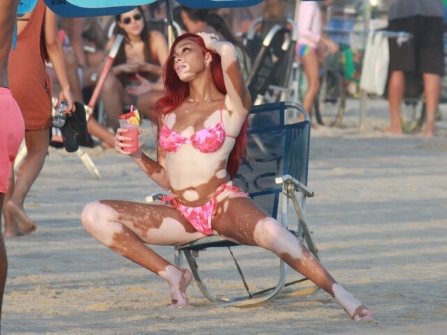 Winnie Harlow