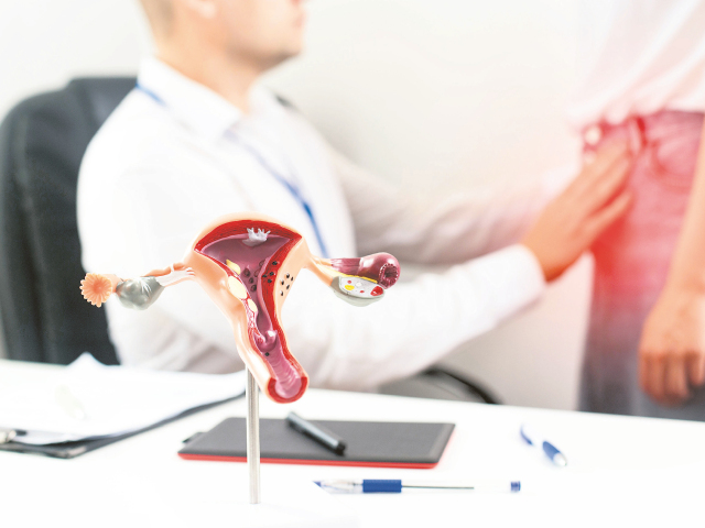 maternica, gynekológ, myómy, endometrióza, menzes