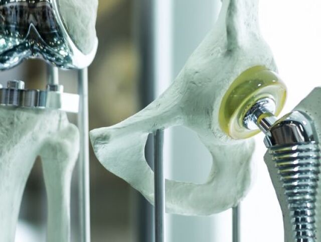 kost implantat