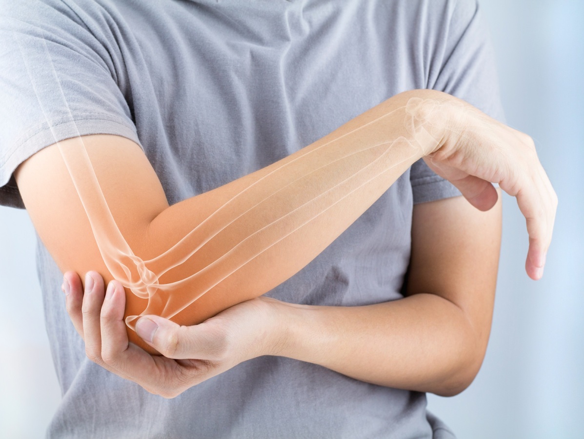 osteoporóza, ruka, bolesť kostí, ochorenie kosti