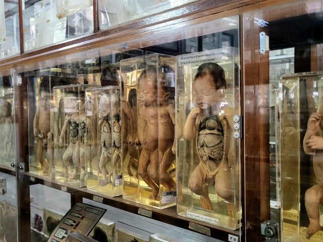 Anatomické múzeum, Bangkok