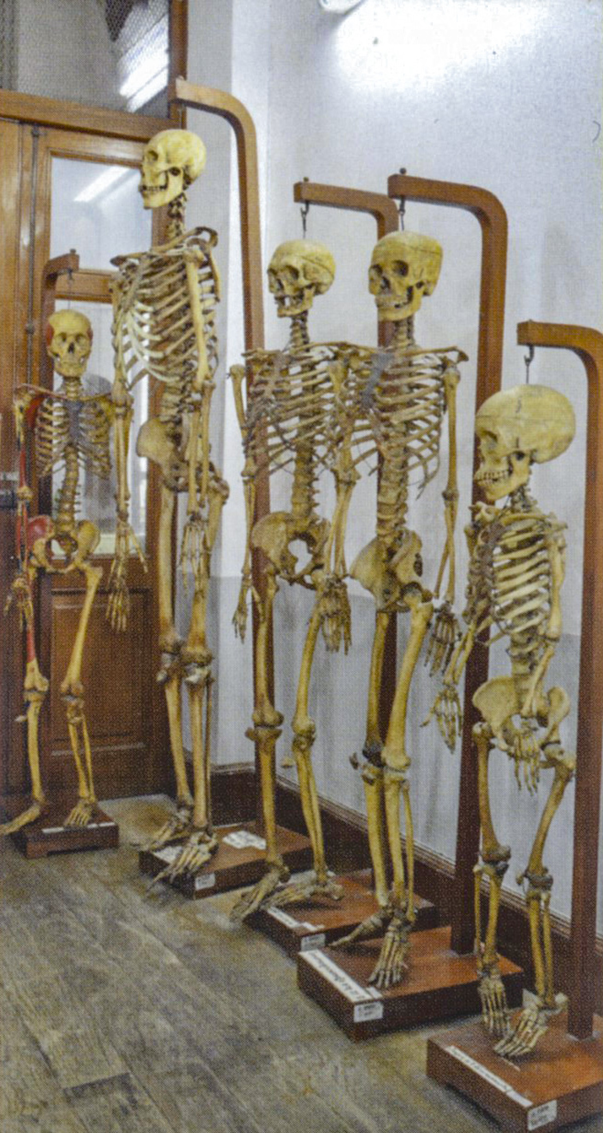 anatomické múzeum, Bangkok, kostra, kostry
