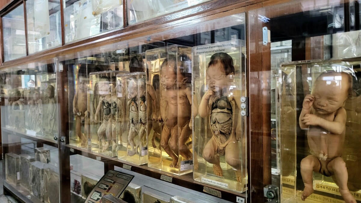 Anatomické múzeum, Bangkok
