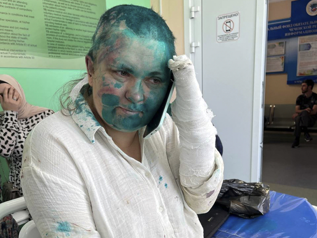 Rusko Čečensko novinárka investigatívna zbitá