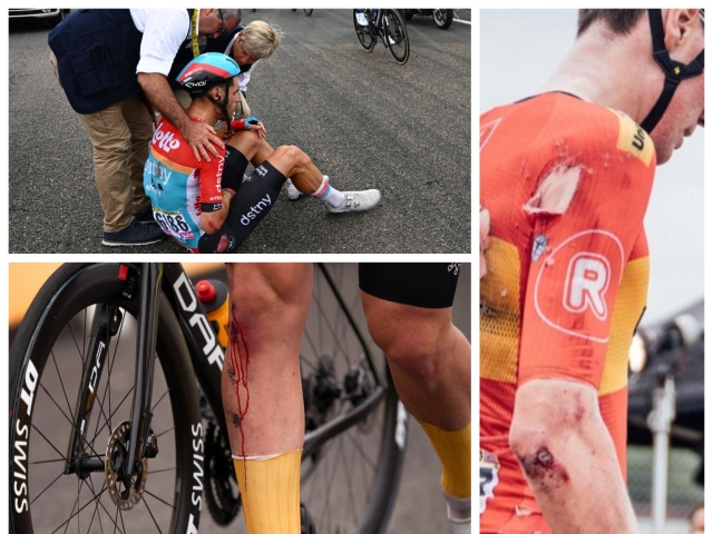 Tour de France, pády, odreniny