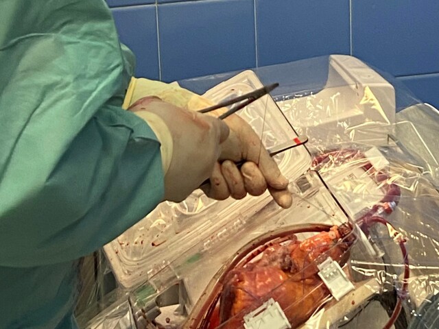transport, srdce, transplantácia