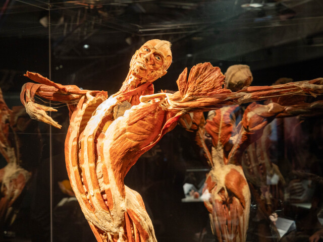 výstava Body Worlds, plastinácia