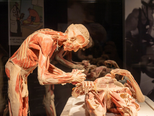 výstava Body Worlds, platinácia
