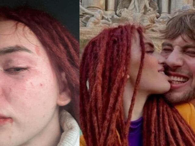 rachel karnižova, tommy kotty