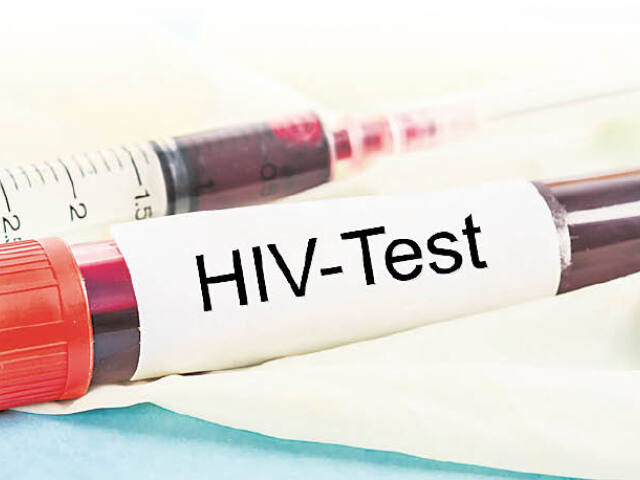 HIV, vírus, AIDS, skúmavka, krv, test
