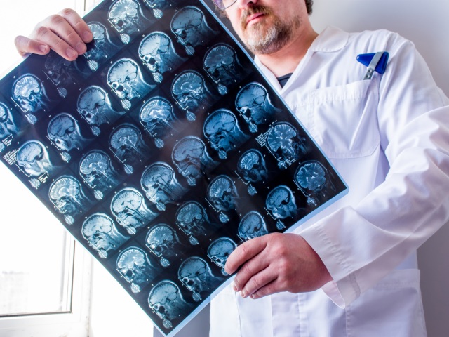 doktor, neurológ, neurológia