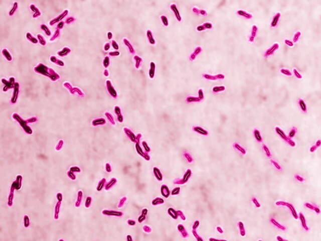 Čierny kašeľ / Pertussis /