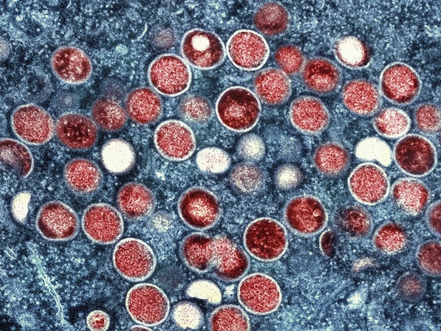 Mpox / Opičie kiahne /