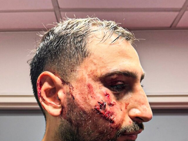 Gianluigi Donnarumma