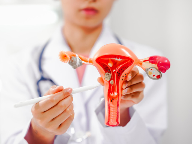 endometrióza, gynekologička