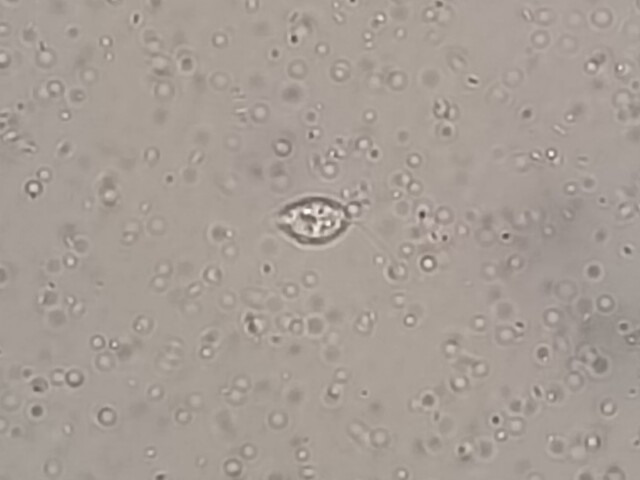Naegleria fowleri - dvojbicikate stadium
