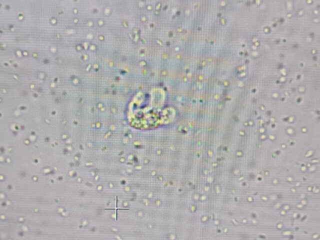 Naegleria fowleri - trofozoit
