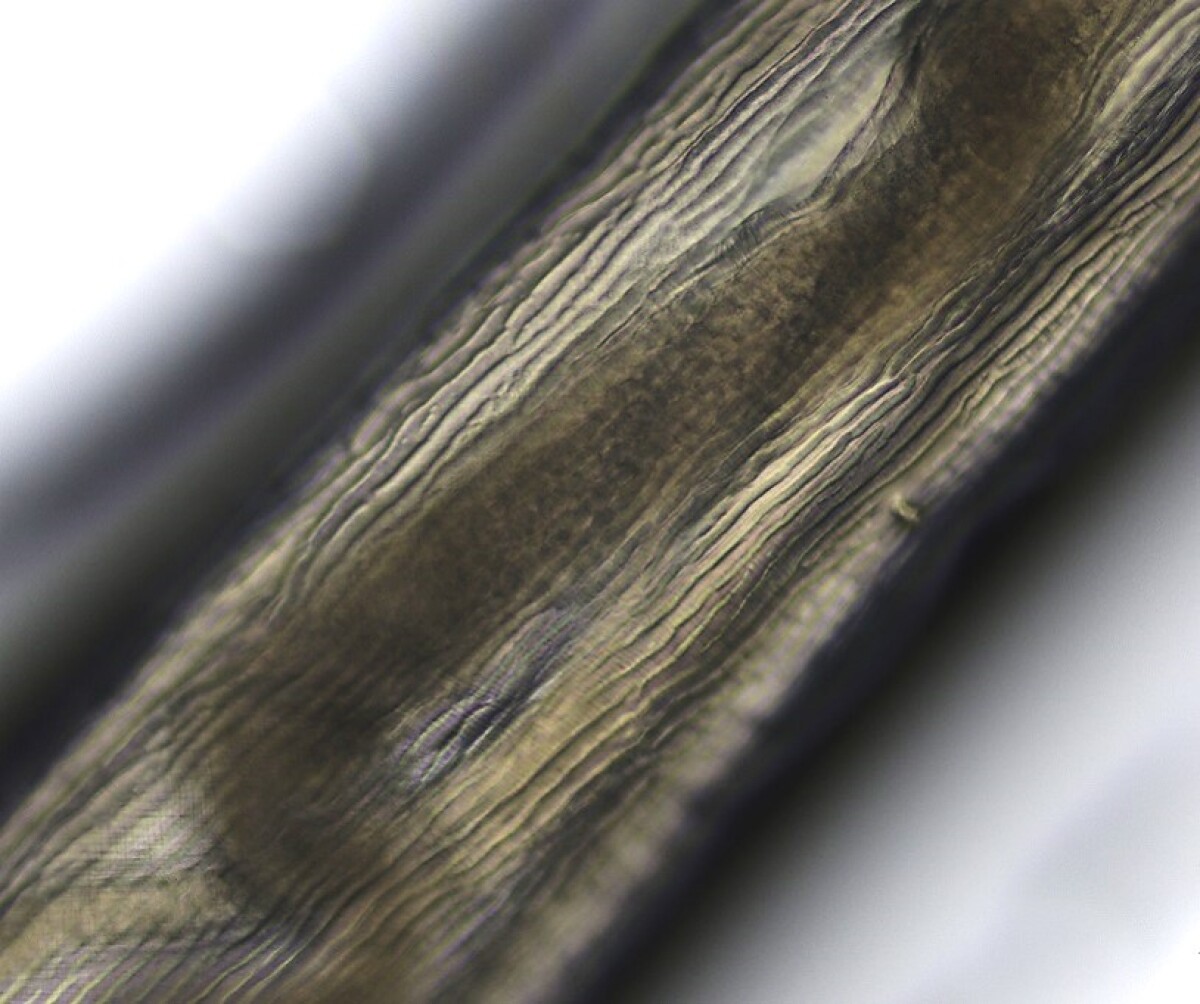 Dirofilaria repens, parazitický červ, filarióza