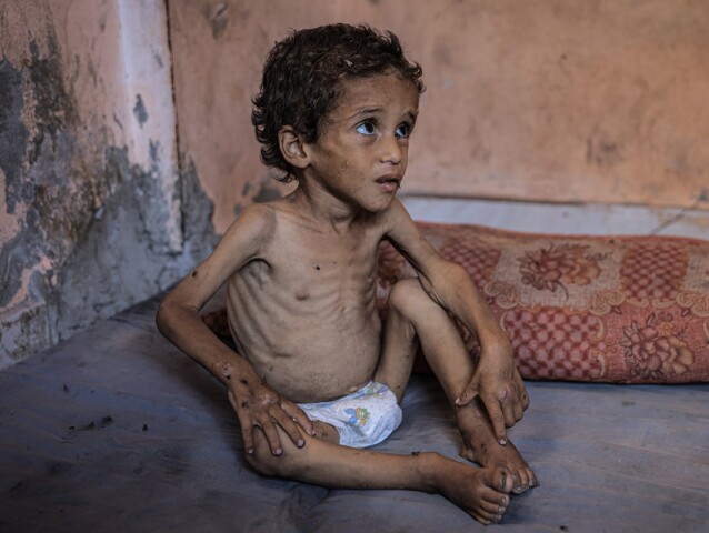 Pásmo Gaza, hlad, hladomor, genocída, Gaza, Palestínčan
