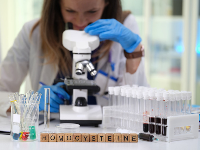 krv, laboratórium