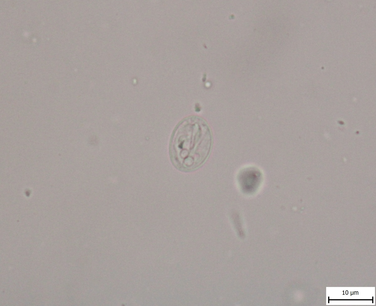 Giardia duodenalis 