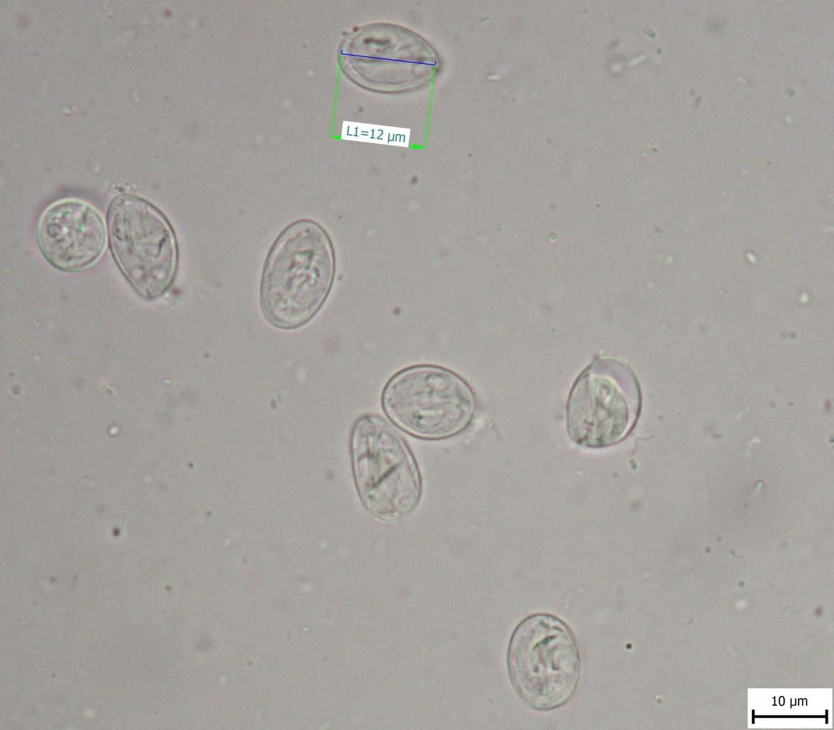Giardia duodenalis 