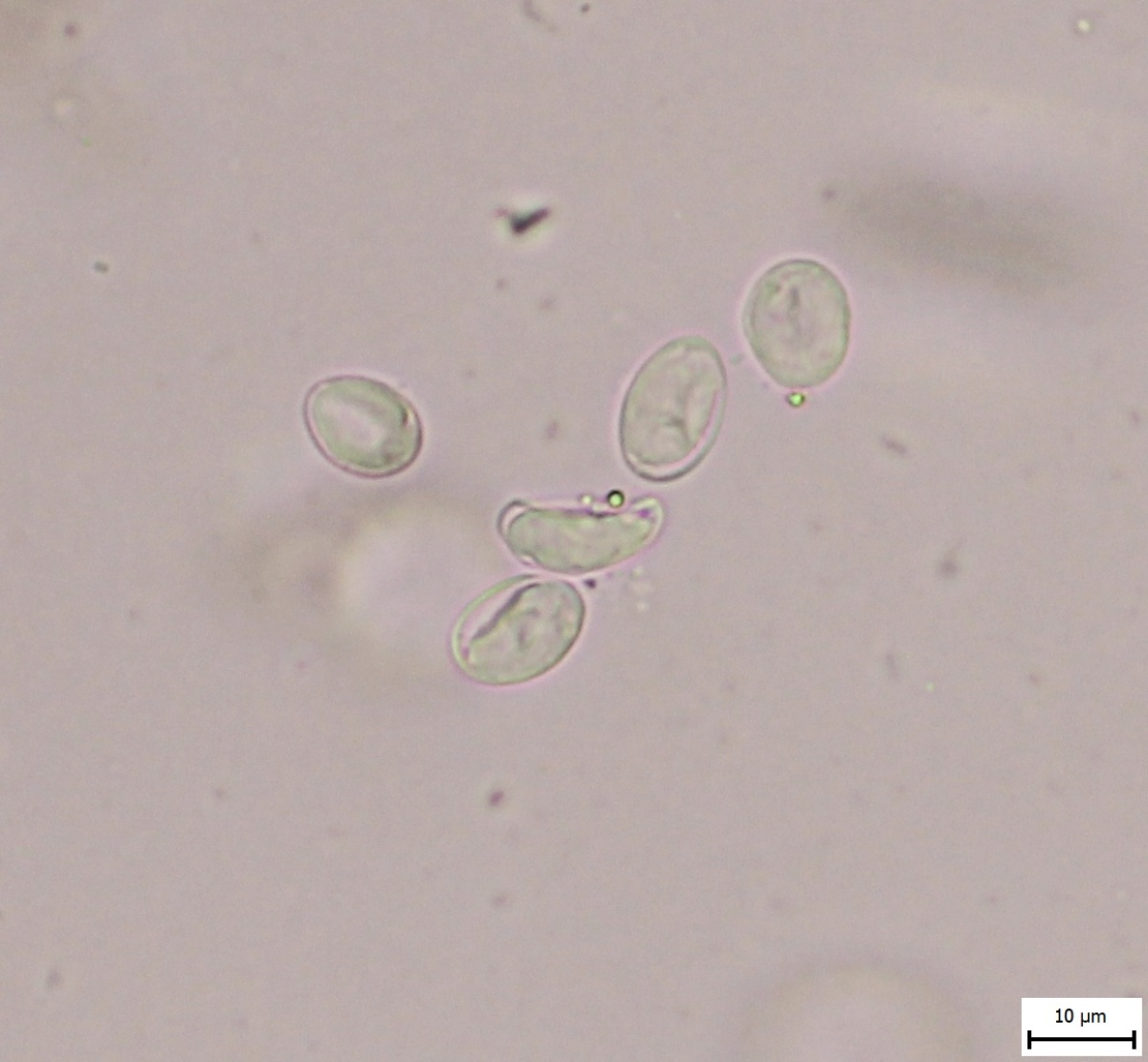 Giardia duodenalis 