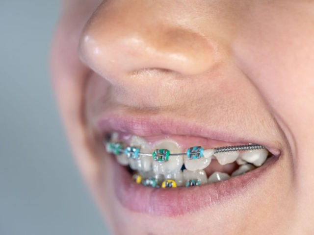 Ortho Keep Smiling