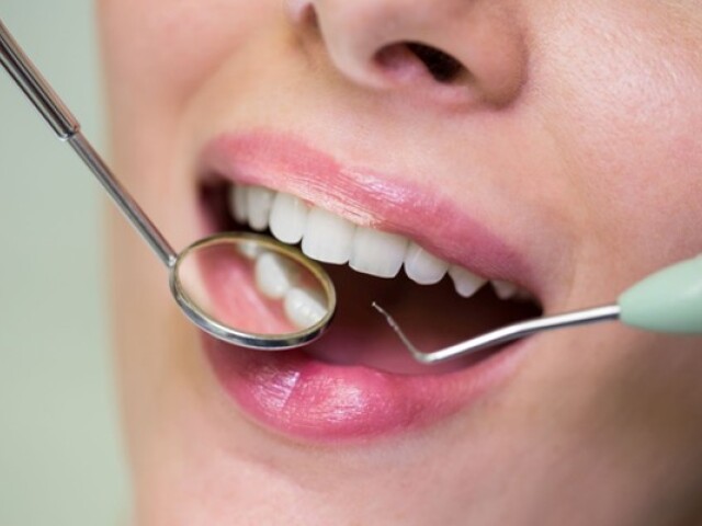 dentalna hygiena
