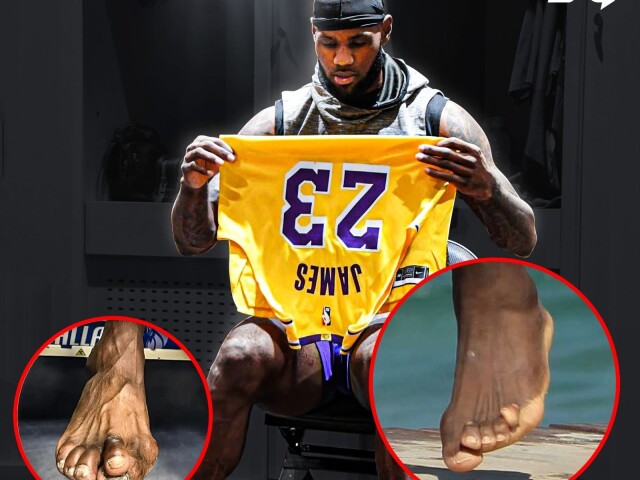 Nepekný pohľad. LeBron James ukázal, ako mu 23 rokov kariéry v NBA deformovalo nohy